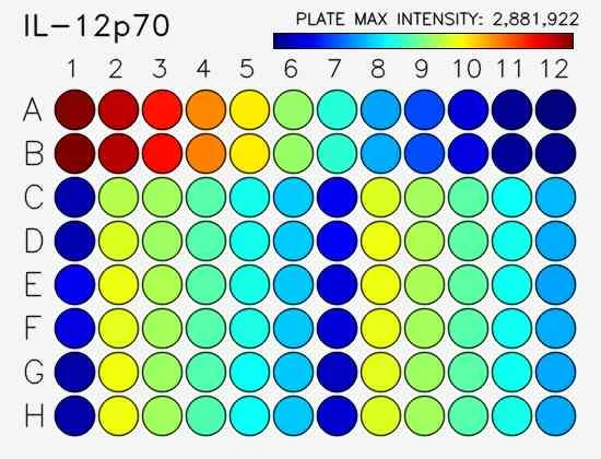 Sensitivity.webp