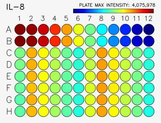 Sensitivity.webp