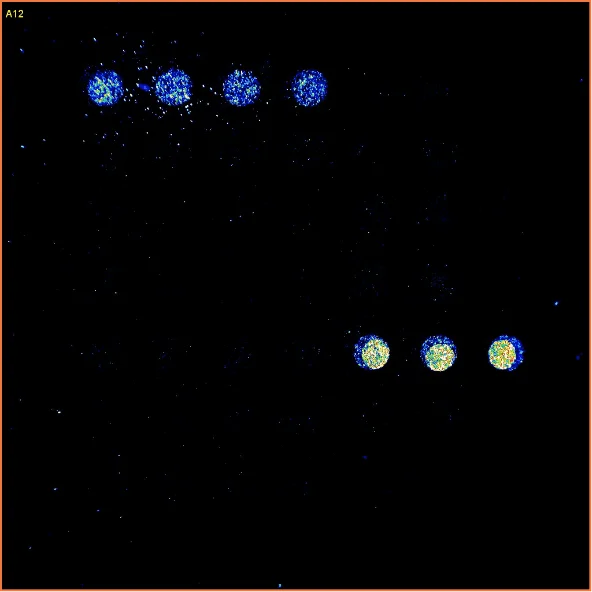 Negative Sera